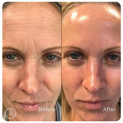 Wrinkle-Smoothing Collagen Serum