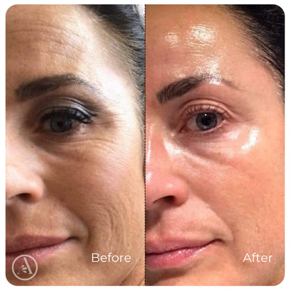 BUNDLE- WrinkleSerum + Collagen Lift Cream
