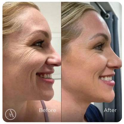 Wrinkle-Smoothing Collagen Serum