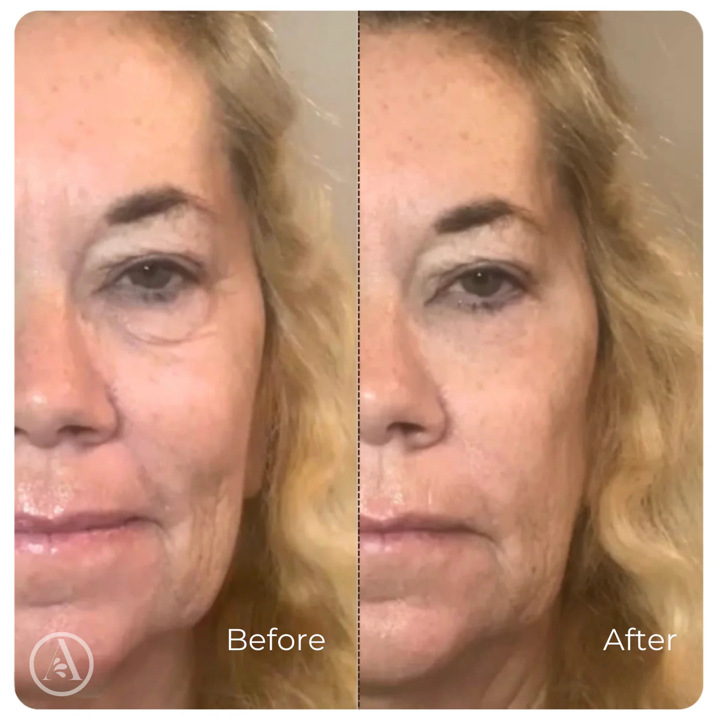 Wrinkle-Smoothing Collagen Serum