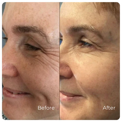 Wrinkle-Smoothing Collagen Serum