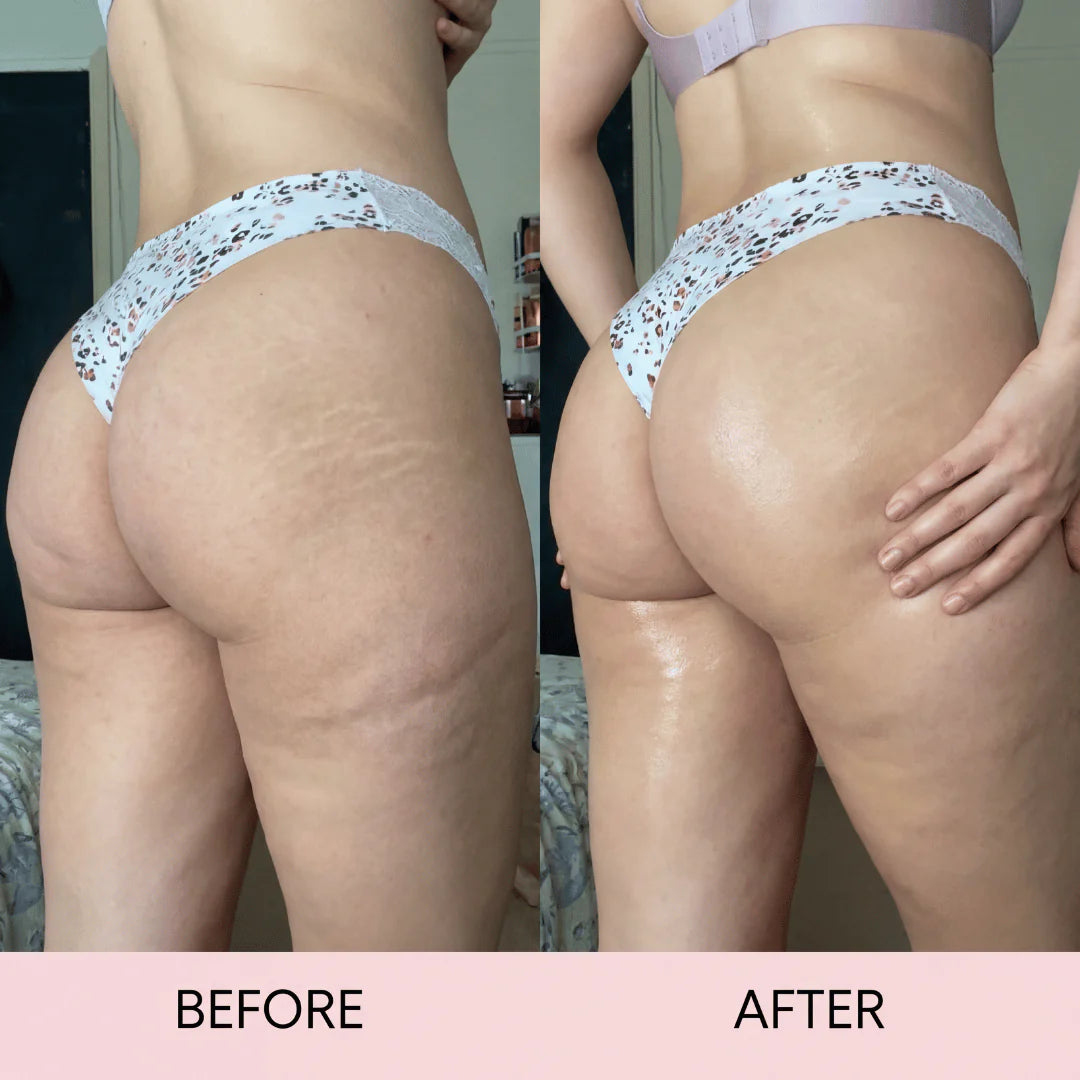 Cellulite Massage Oil