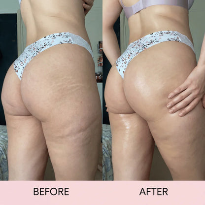 Cellulite Massage Oil