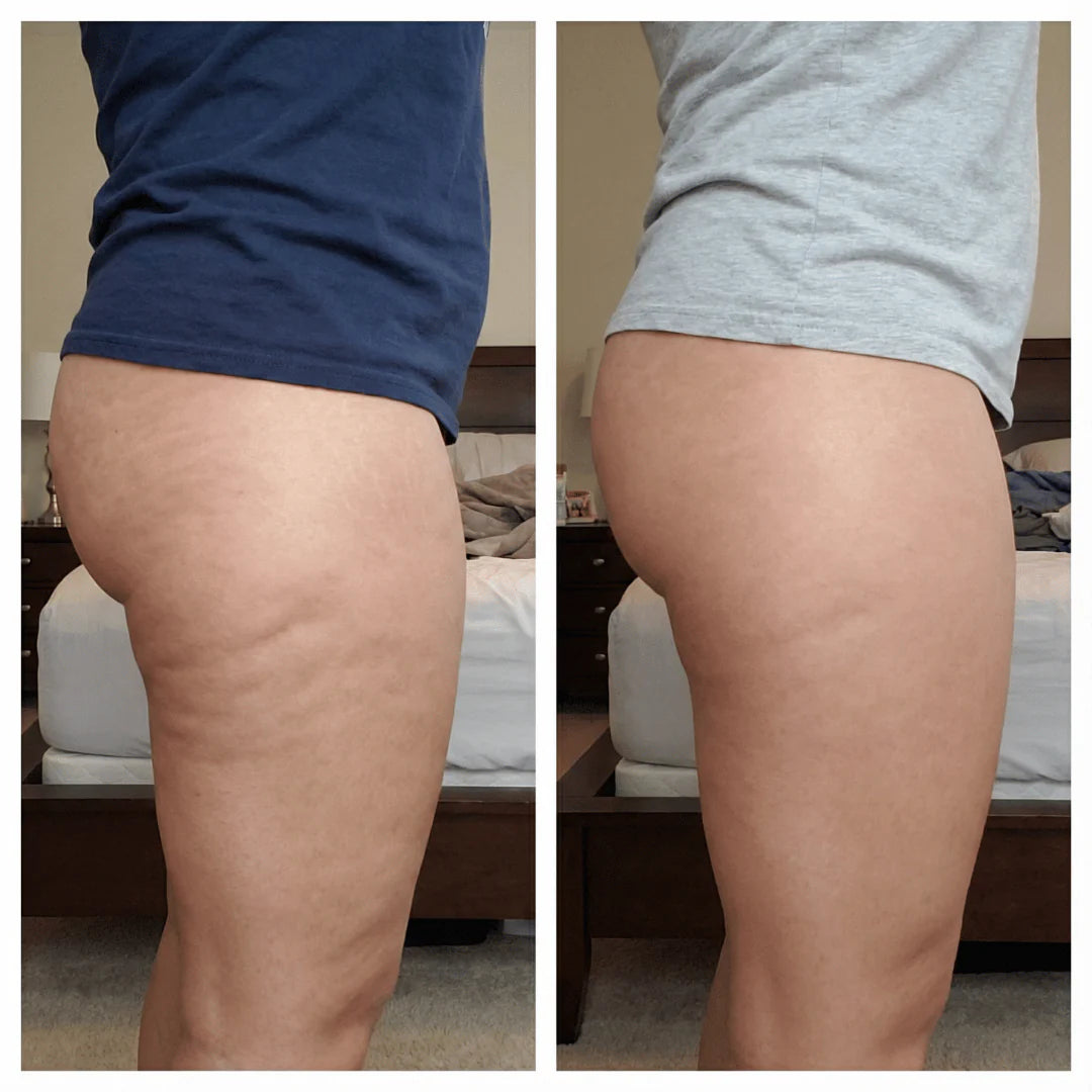 Cellulite Massage Oil