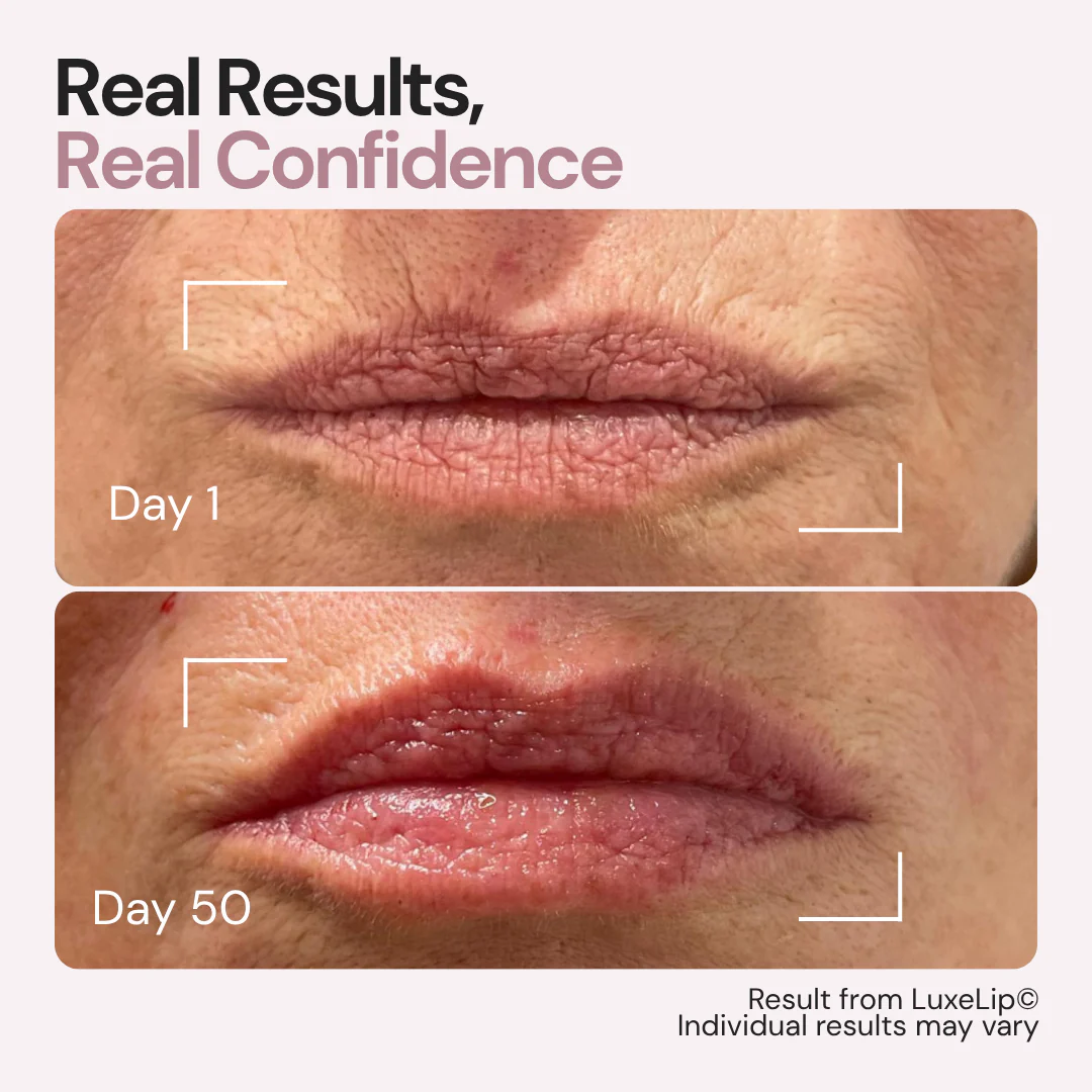 The First 4-Wavelength LED Lip Device - The Real Alternative to Lip Fillers That Rejuvenates Your Lips From Within