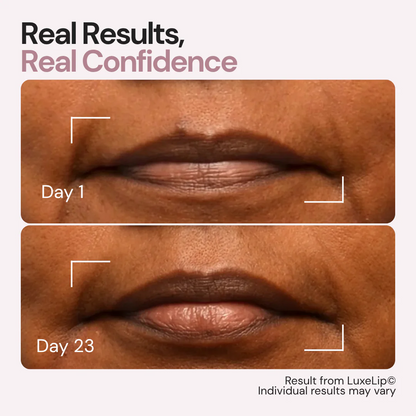 The First 4-Wavelength LED Lip Device - The Real Alternative to Lip Fillers That Rejuvenates Your Lips From Within