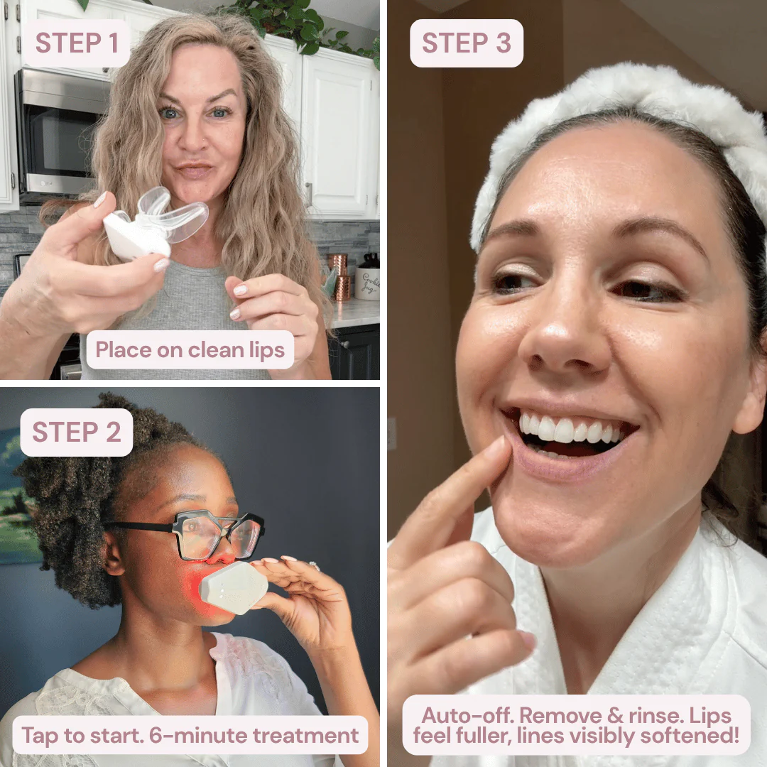 The First 4-Wavelength LED Lip Device - The Real Alternative to Lip Fillers That Rejuvenates Your Lips From Within