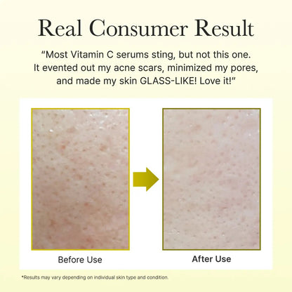 Vitamin C Booster Shot 15ml