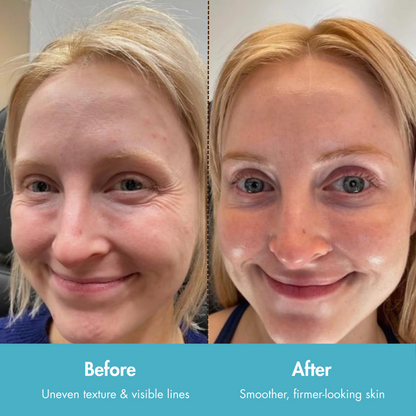BUNDLE- WrinkleSerum + Collagen Lift Cream