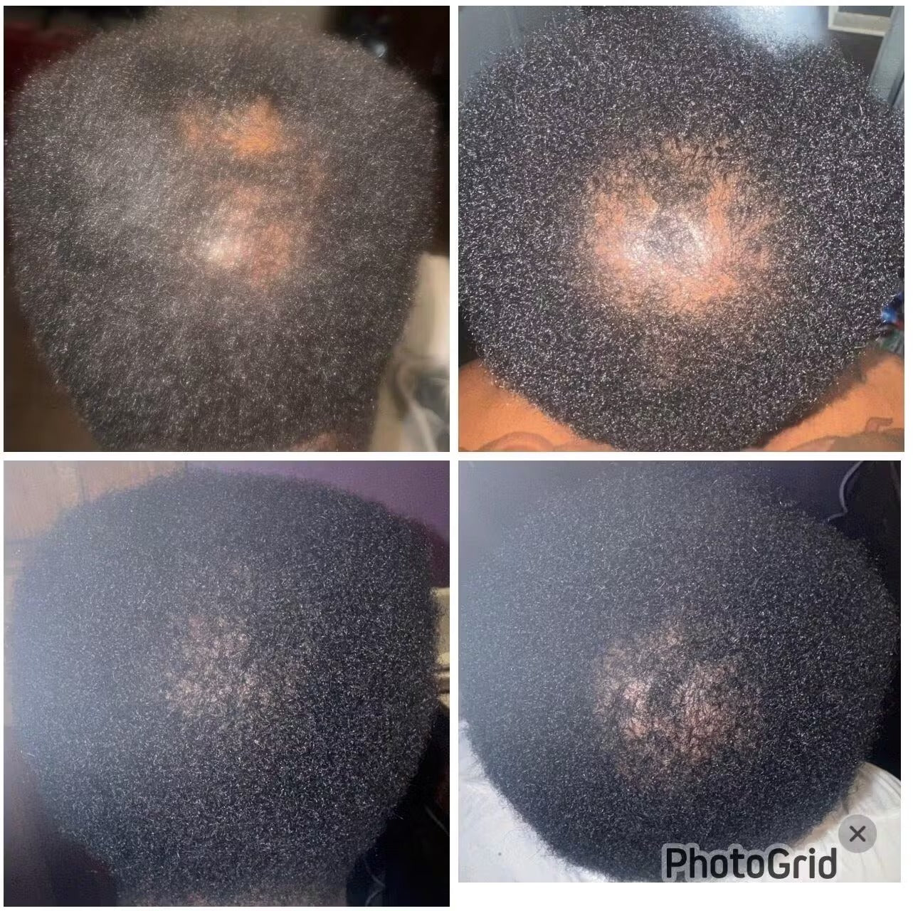 Rosemary+Fenugreek Hair Growth Oil