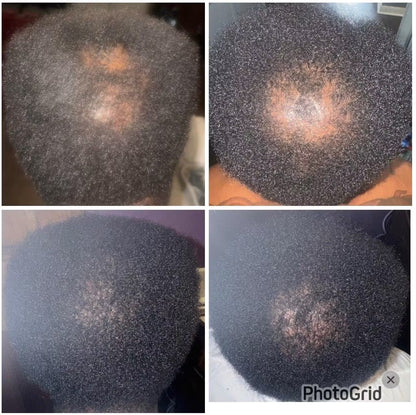 Rosemary+Fenugreek Hair Growth Oil