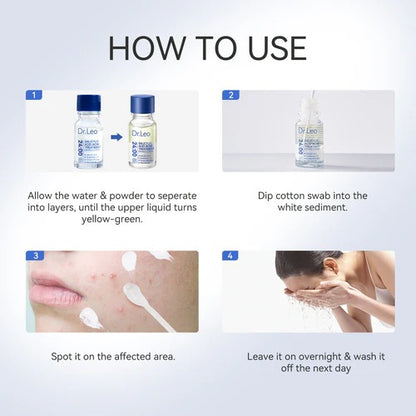 Salicylic Acid Acne Treatment