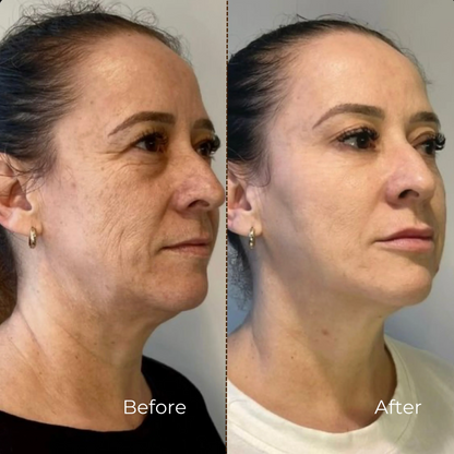 BUNDLE- WrinkleSerum + Collagen Lift Cream