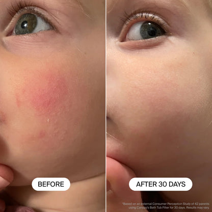Baby Bath Tub Filter