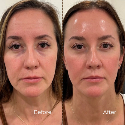 BUNDLE- WrinkleSerum + Collagen Lift Cream